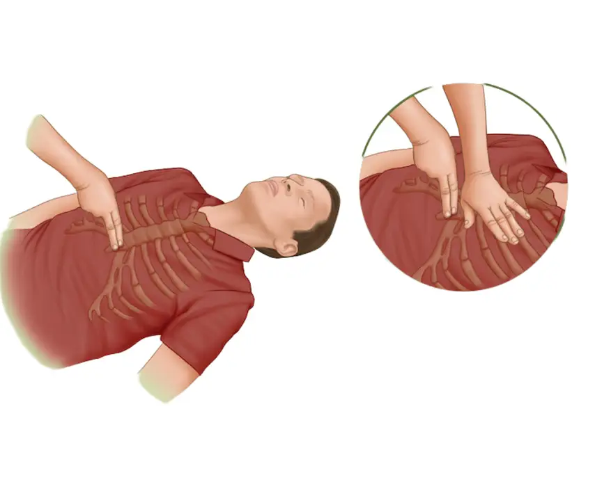 Xiphoid Process